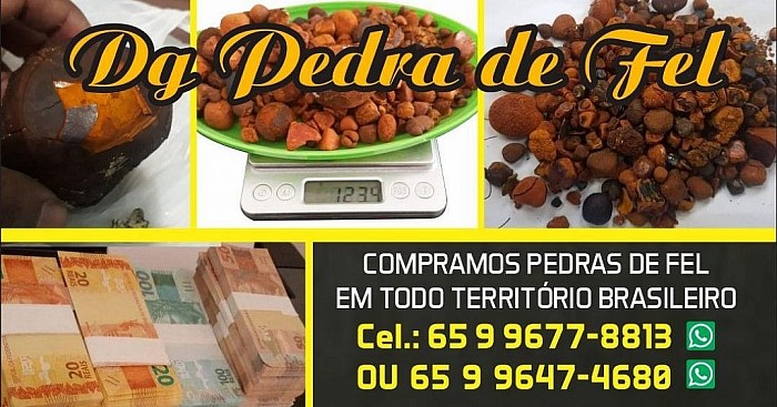 Pedras de fel bovinos