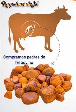 Tem pedra de fel ? Chama que agente compra